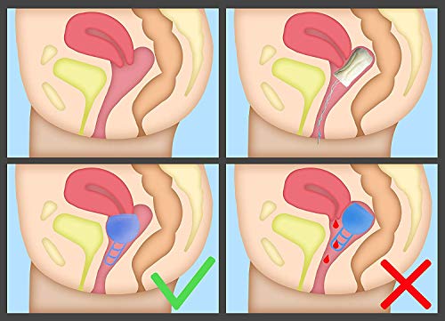 Merula Cup apple (grün) - One size Menstruationstasse aus medizinischem Silikon - 4